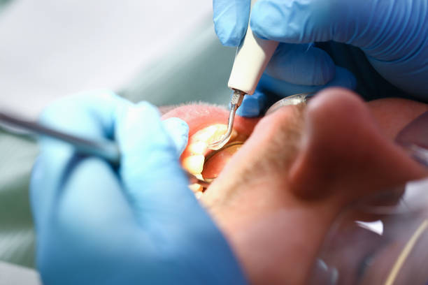 Best Emergency Treatment for Toothache in San Felipe Pueblo, NM